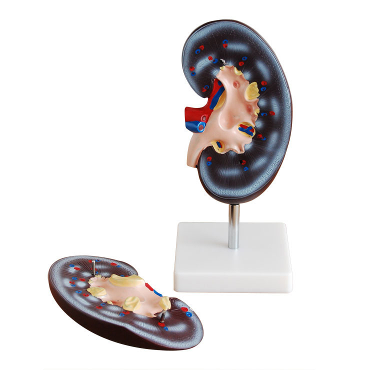 腎解剖模型2件