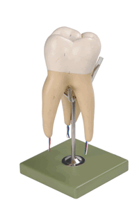 磨牙有三個牙根模型