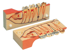 牙分解组织模型