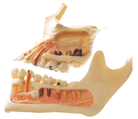 牙体病变模型