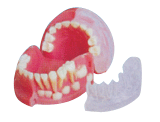 三歲乳恒牙交替解剖模型