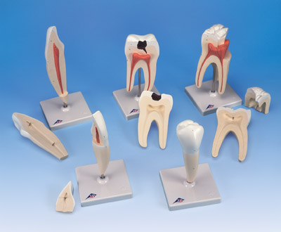 经典牙齿模型系列，5种模型